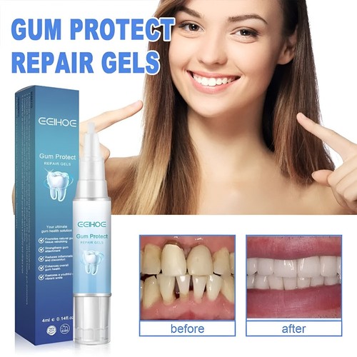 Mullend gum repair gel 2026 - mullend,
